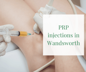 PRP injections in Wandsworth (2)