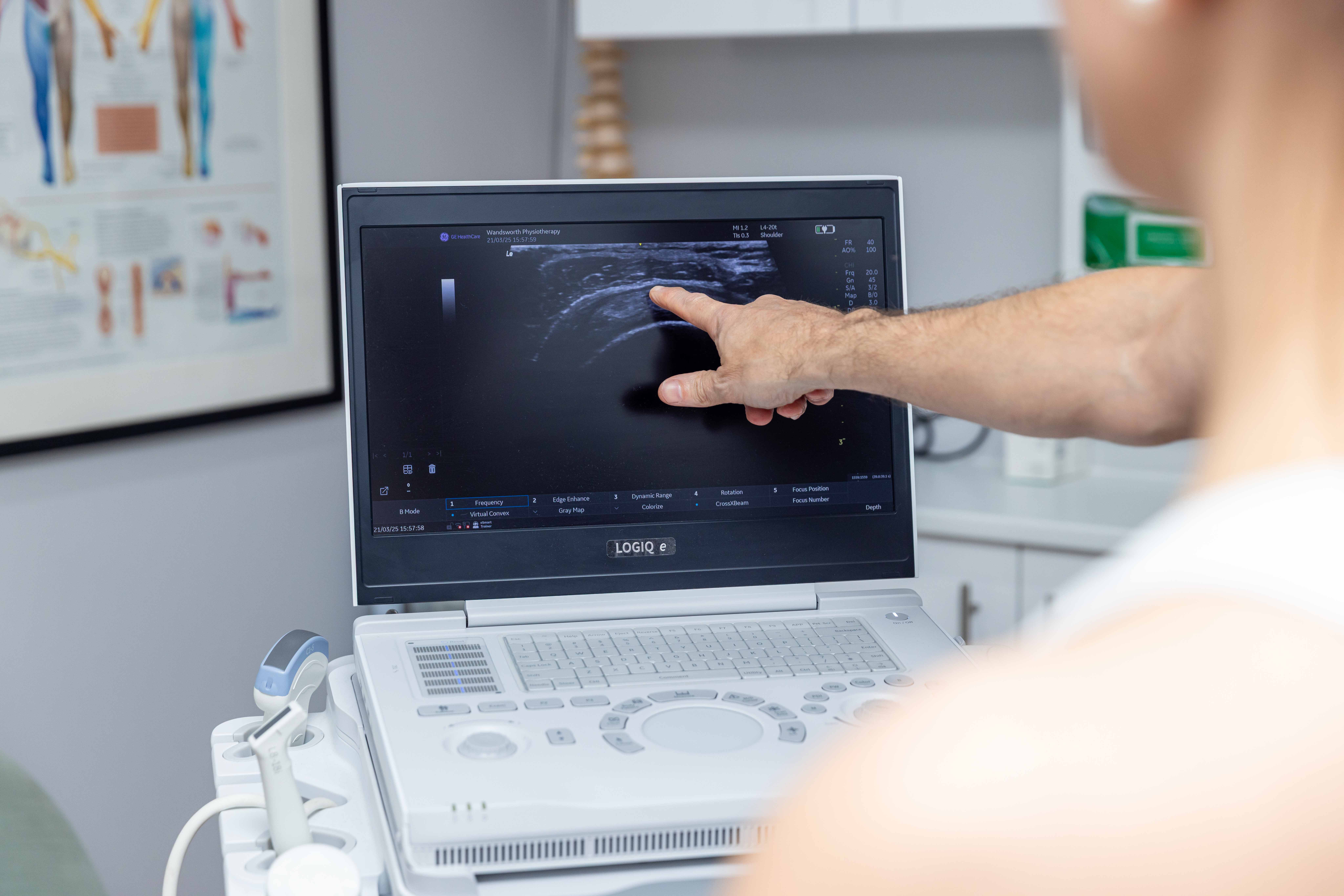 Clapham Junction Physiotherapy and ultrasound scans