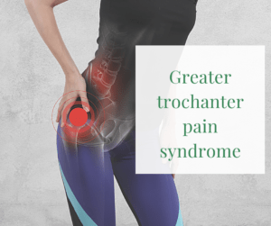 Greater trochanter pain syndrome
