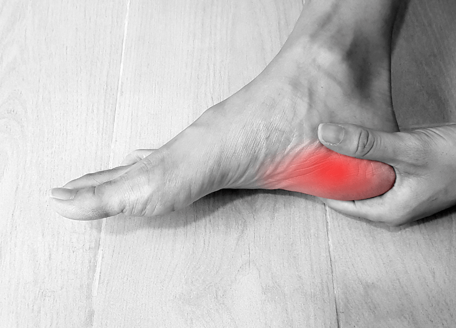 UPDATED: Running injuries of the foot – plantar fasciitis