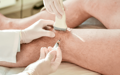 Ultrasound guided injections in Wandsworth