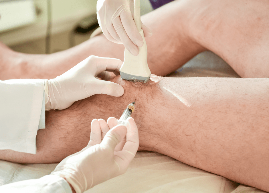 Hyaluronic acid injections for knee pain