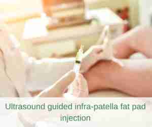 Ultrasound guided infra-patella fat pad injection