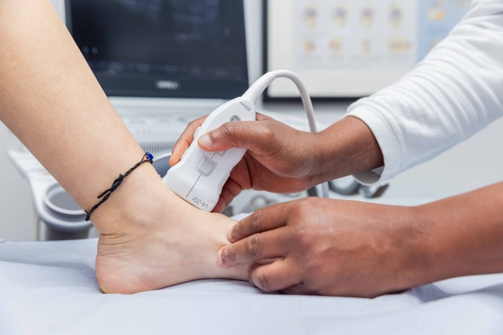 Ultrasound scan the m common forefoot conditions