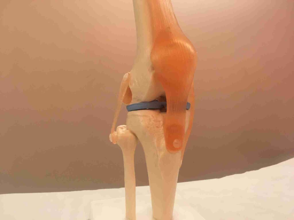 The most common sports Injury 1 IMG 4781