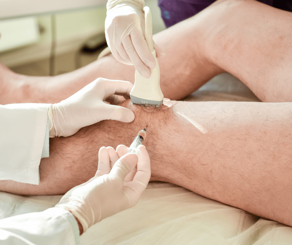 Ultrasound guided injections in Wandsworth 15 Ultrasound guided injections 1