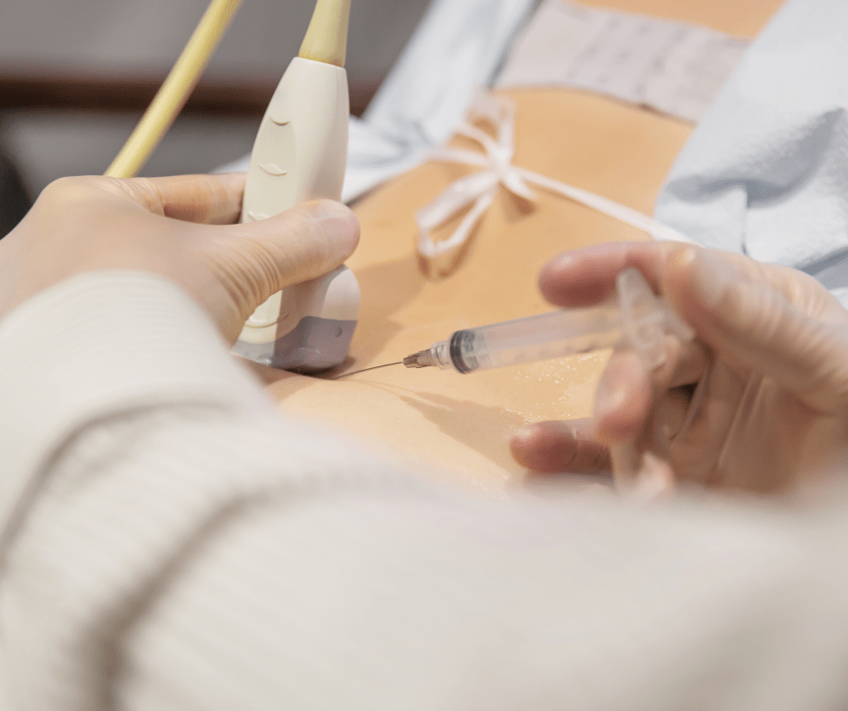 Ultrasound guided steroid injections 1 Ultrasound guided steroid injection