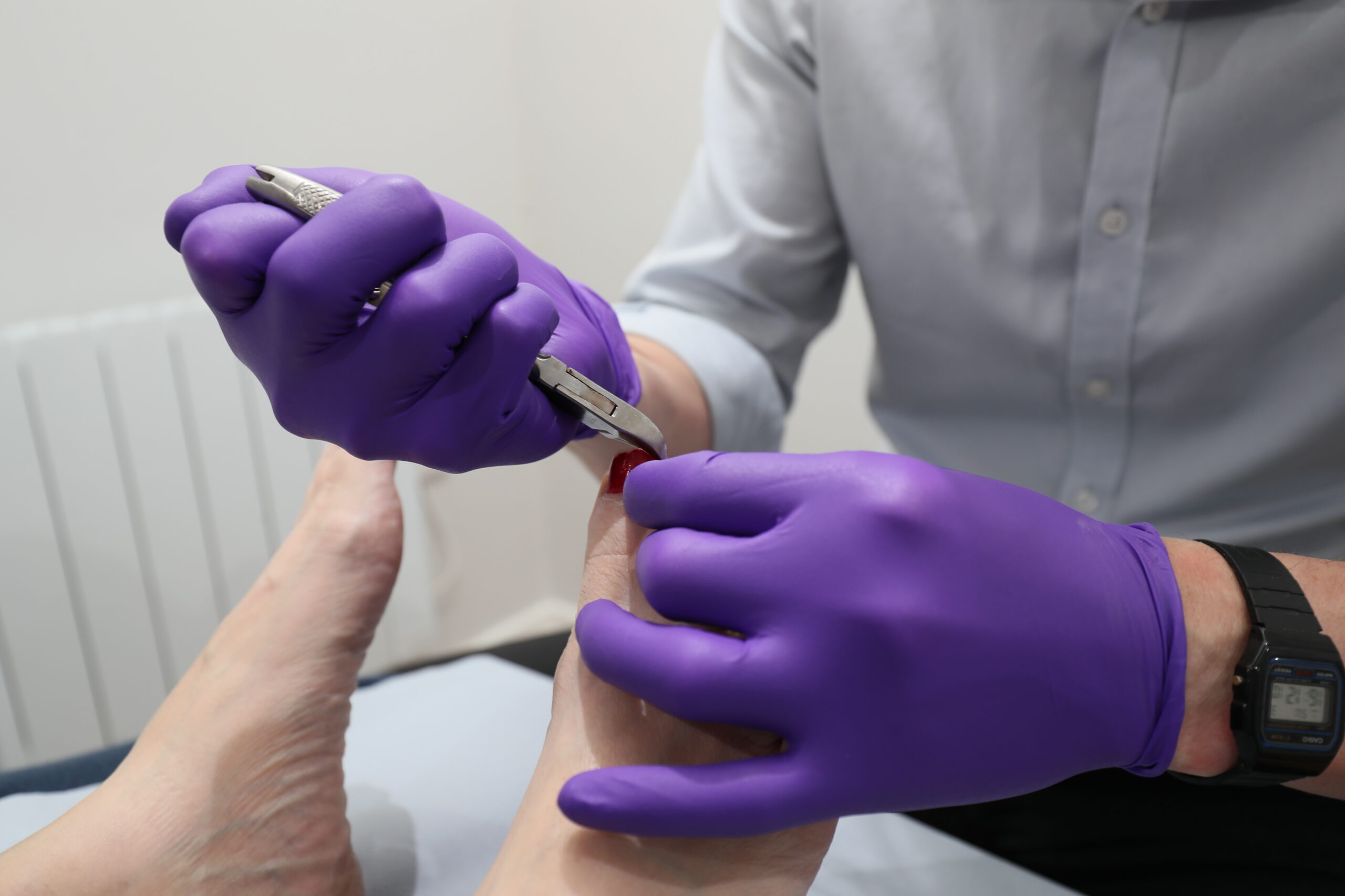 Wandsworth podiatry and nail surgery