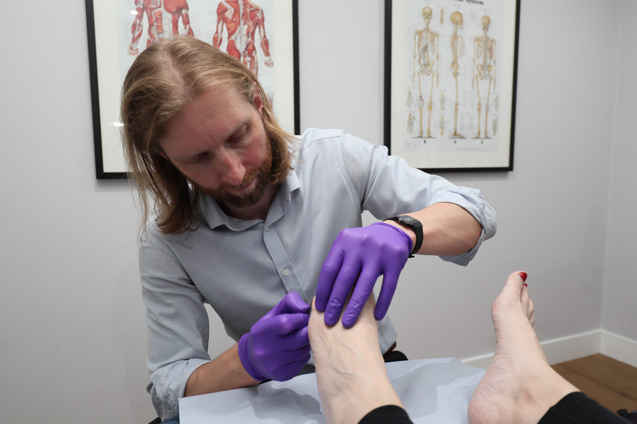 Verruca treatment in Wandsworth